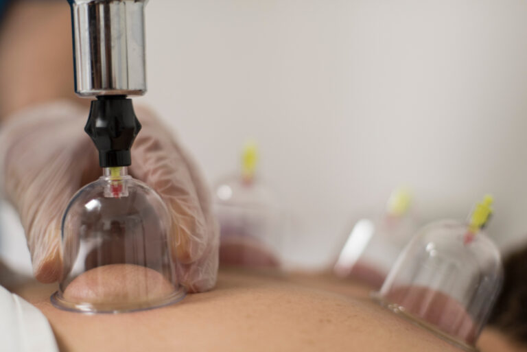 للنساء فقط.. الحجامة تخلصك من مشاكل الرحم